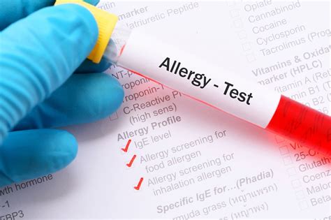 blood test for allergies children